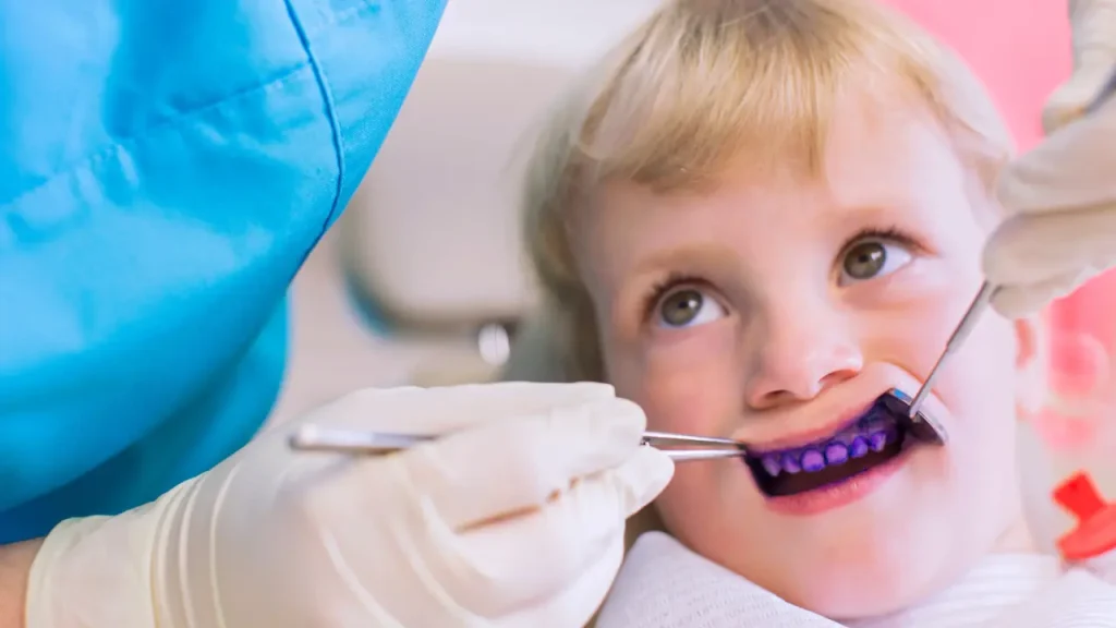 Child receiving Silver Diamine Fluoride treatment to help manage tooth decay during a pediatric dental visit