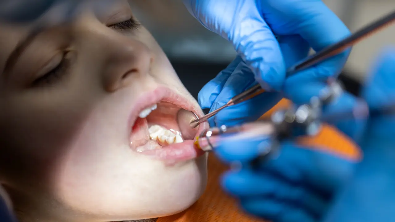 Pediatric dentist performing a gentle tooth extraction for a child in Dubai