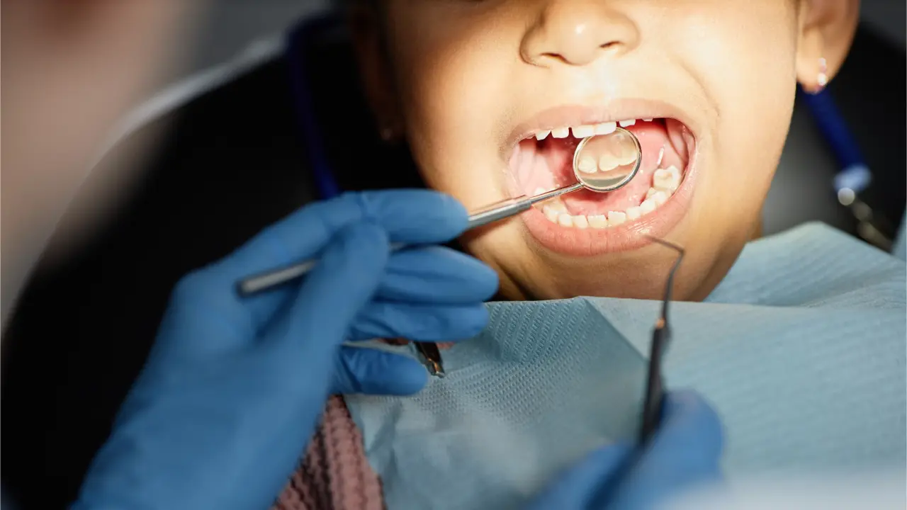 Pediatric dentist examining a child's teeth during a routine dental checkup in Dubai